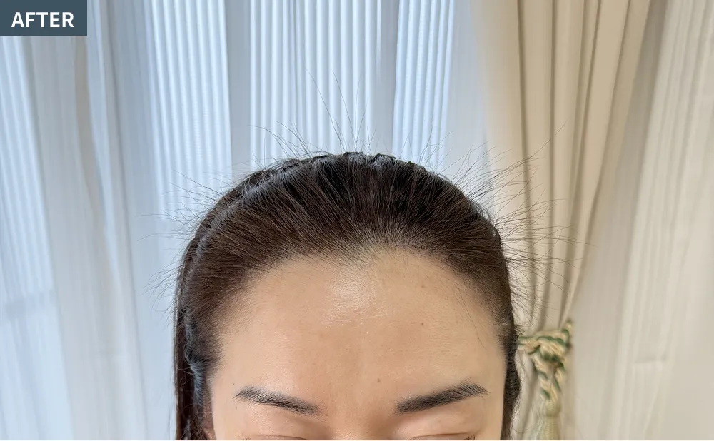 HANE scalp NORTHのヘアタトゥーアフター