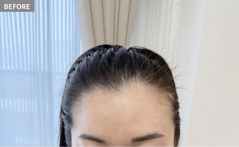 HANE scalp NORTHのヘアタトゥービフォー